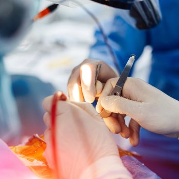 Neurosurgery