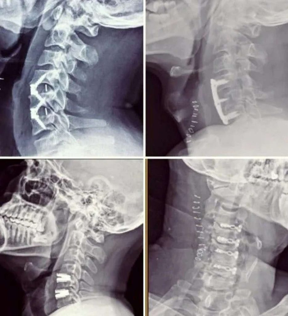 spine img 2